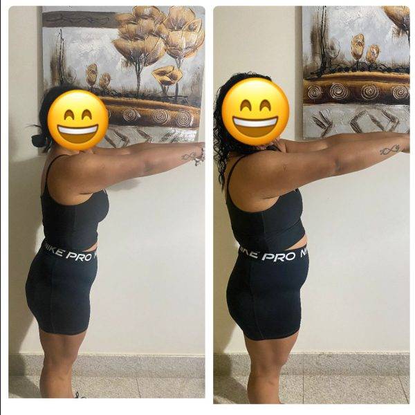 Klebia-antes-e-depois-22-07-24